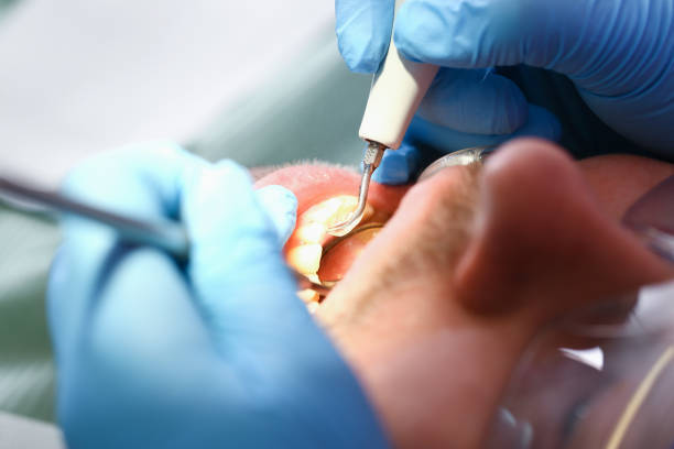 Best Root Canal Emergency Dentist  in Bruceville Eddy, TX